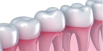 Image of teeth in a row sitting in healthy gums